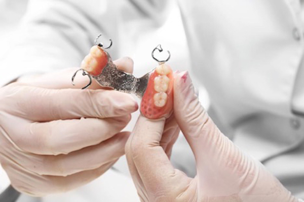 Dentist Inspects a Patient’s Partial Dentures for Any Form of Damage